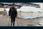 Un menor con discapacidad en un refugio temporal en Gaza (Foto: UNRWA)