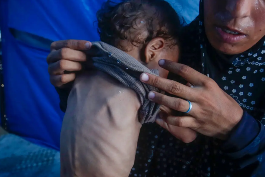 ONU registra casi 95.000 casos de desnutrición infantil en Gaza en 2025