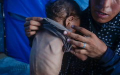 ONU registra casi 95.000 casos de desnutrición infantil en Gaza en 2025